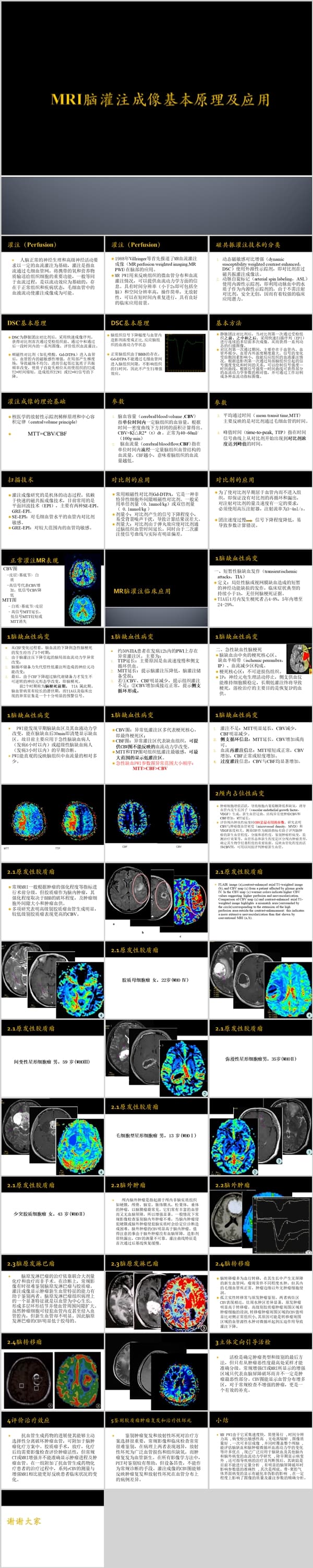 MRI脑灌注成像基本原理及应用.ppt