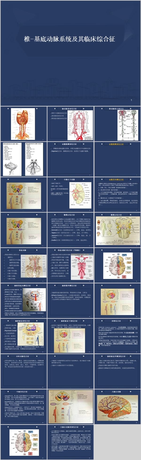 椎-基底动脉系统及其临床综合征.ppt