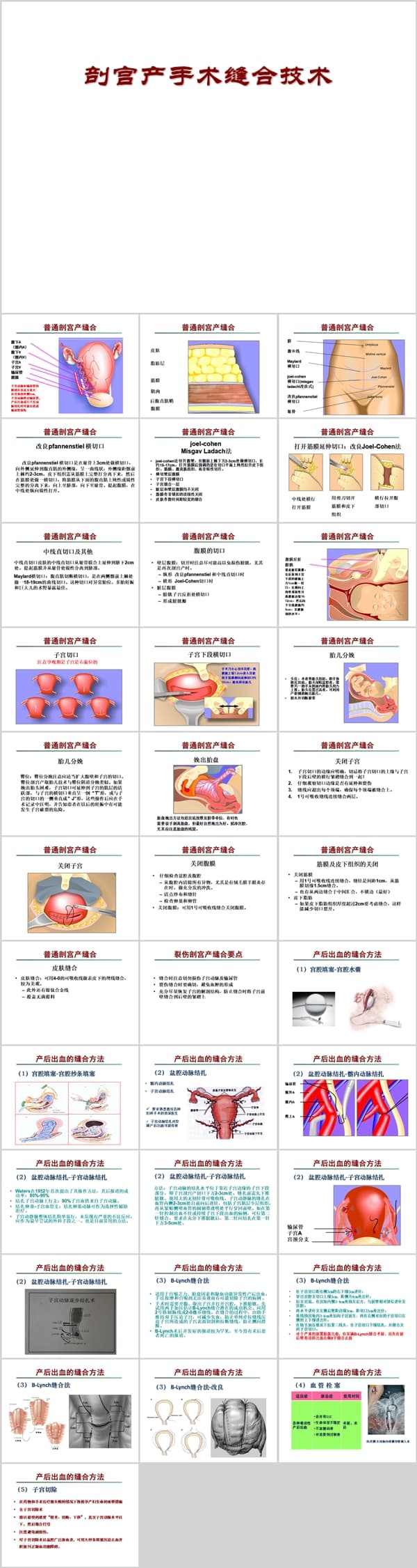 剖宫产手术缝合技术.ppt