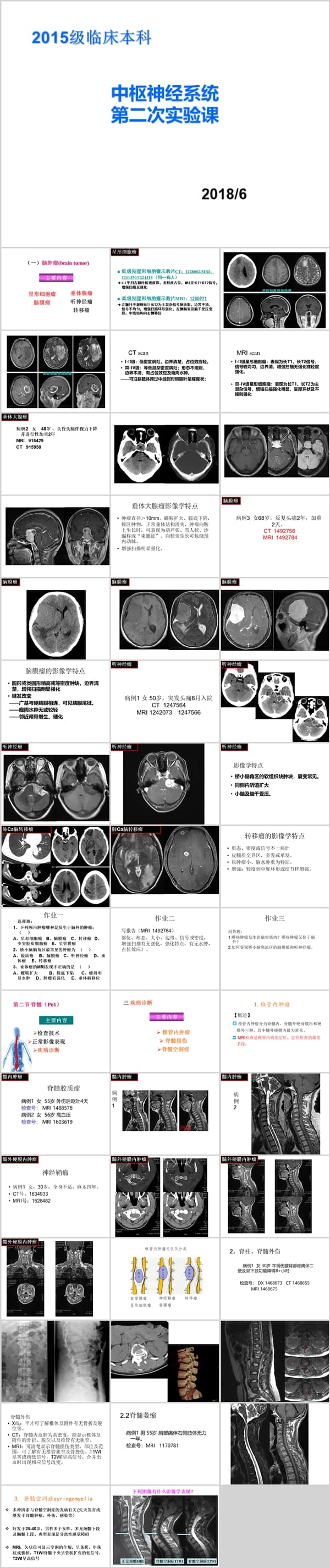 中枢神经系统 第二次实验课（一）脑肿瘤(brain tumor).ppt